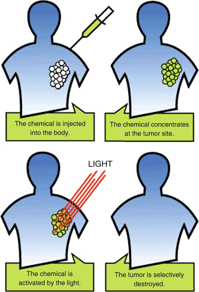 Blog image 1